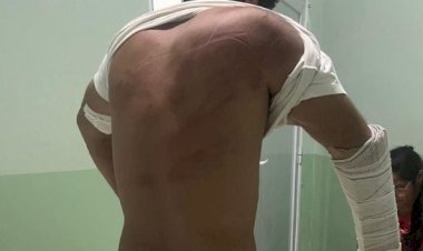 Homem é sequestrado e agredido em MT por dívida de R$ 100