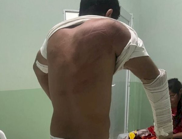 Homem é sequestrado e agredido em MT por dívida de R$ 100