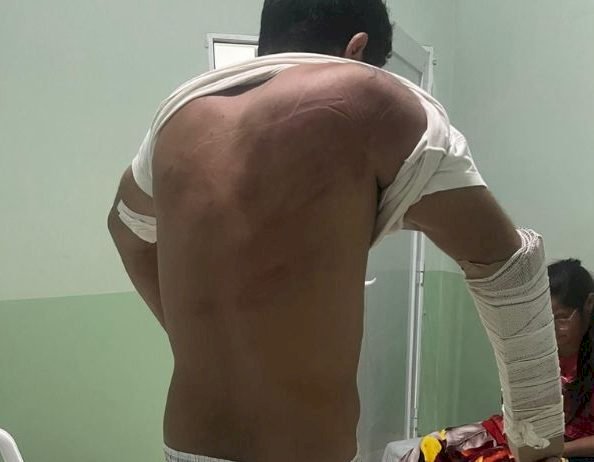 Homem é sequestrado e agredido em MT por dívida de R$ 100