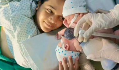 Morre o segundo gêmeo siamês de Canarana (MT) que nasceu em Goiânia